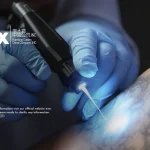 Using Tktx Cream For Tattoo Removal: A Comprehensive Guide